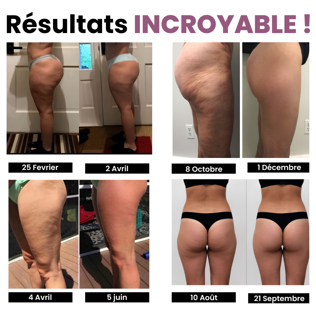 Legging Anti-Cellulite