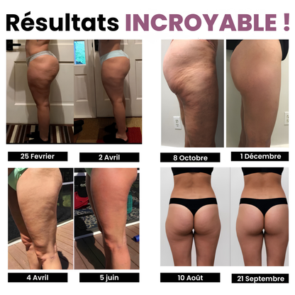 Legging Anti-Cellulite